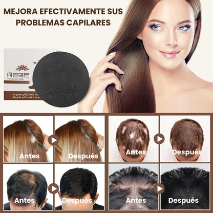 CANABLOCK™| 2*1 JABON ANTICANAS , ANTI CAIDA Y CASPA